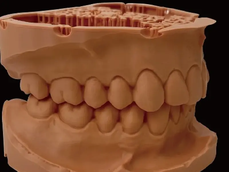 Guide chirurgical dentaire DLP